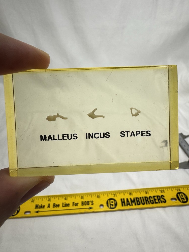 Vintage Embedded Specimen Human Ossicles Ear Bones Osteology