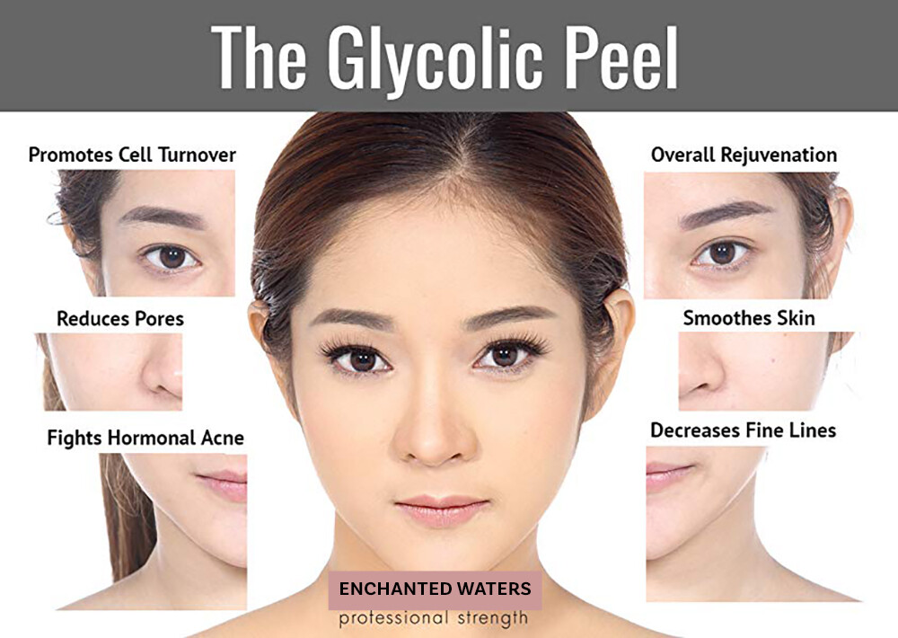 Glycolic Acid Face Peel Kit Medical Grade Pure Acne Scars Wrinkles Anti-Aging