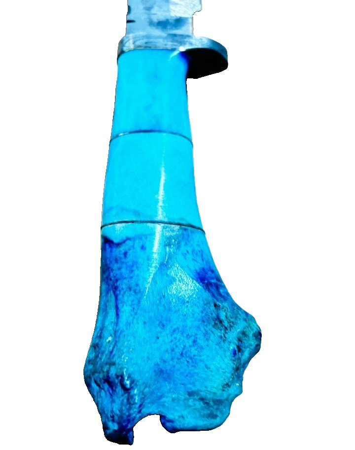 Blue Stag Bone Handle Damascus Fixed Blade Knife, Custom Made