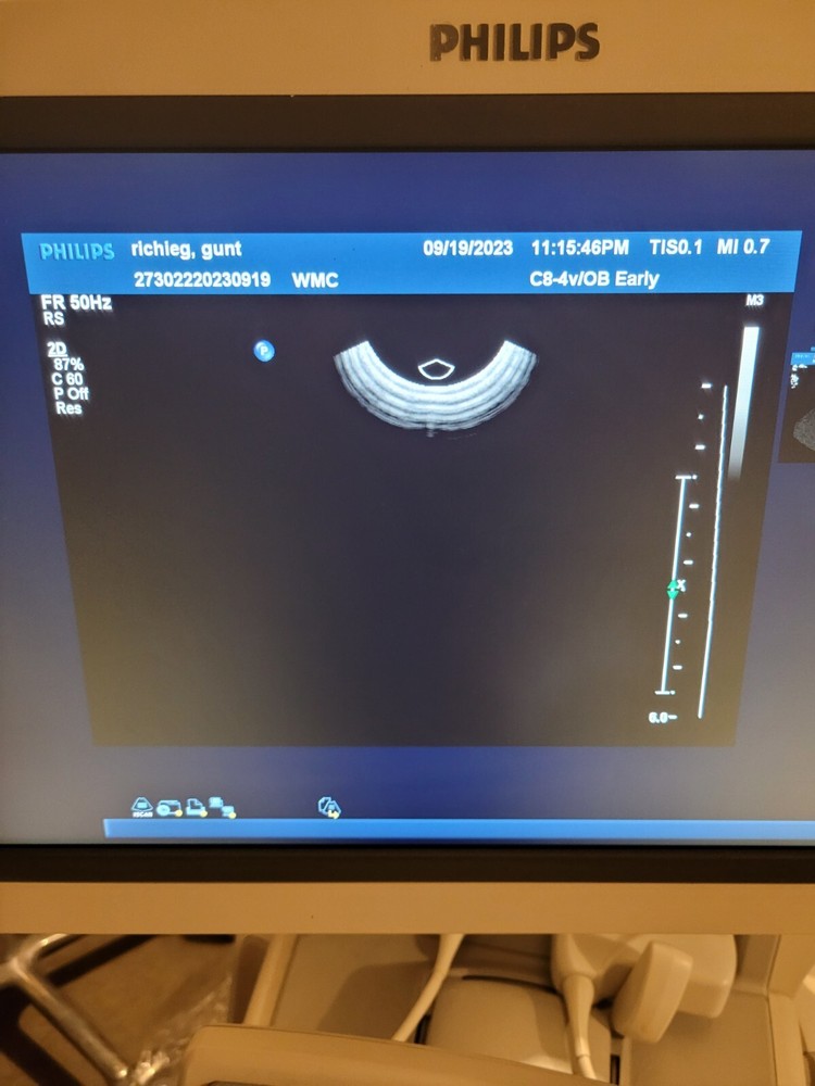 Philips C8-4V Endocavitary Transvaginal Probe 