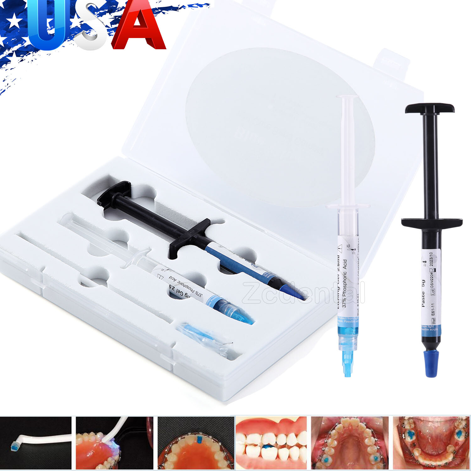 Dental Adhesivo para ortodoncia Fotocurado Sombra Azul Pegamento Resina