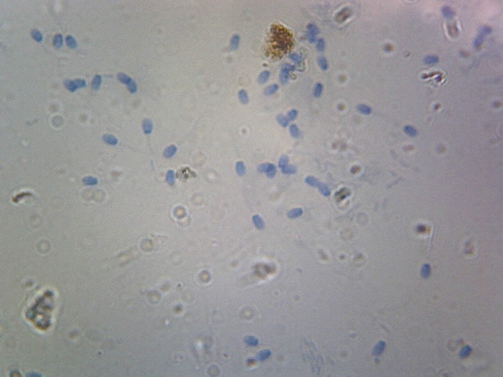 Sperm, Mammalian; Smear