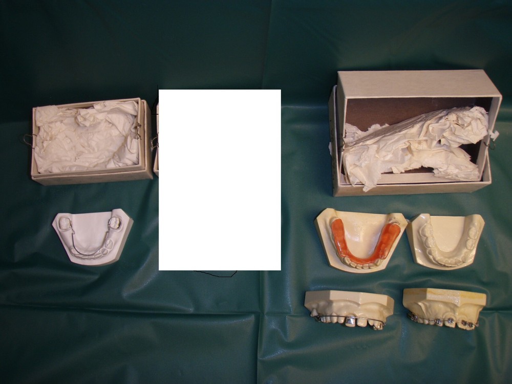 Plastic/Stone Orthodontic Models