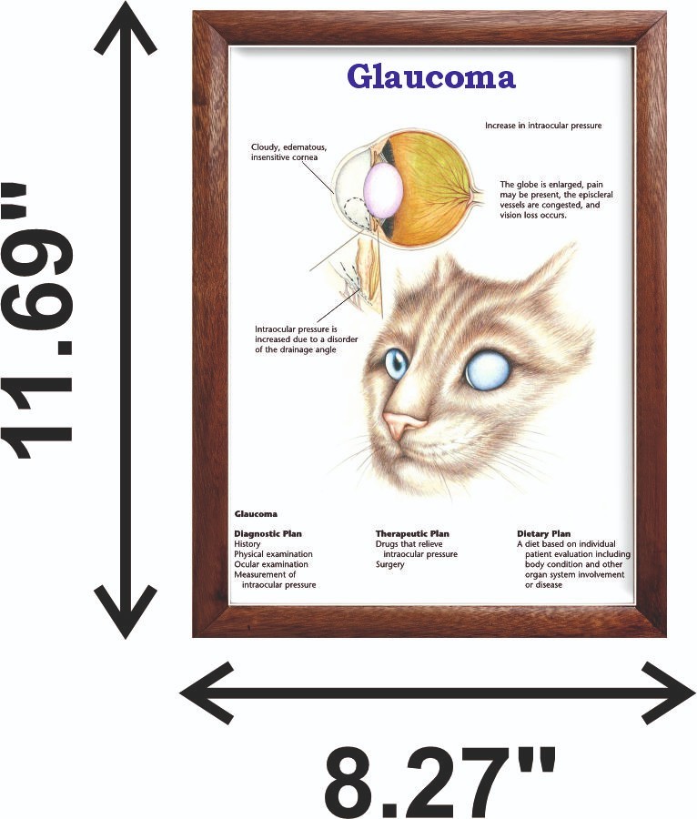 Glaucoma Chart 12x18 inches