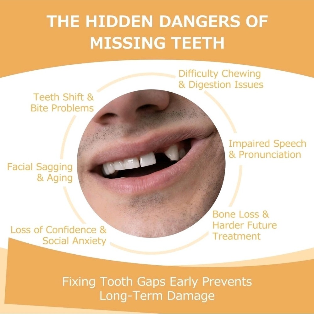Partial Dentures - Dentures for Missing Teeth & Gaps - Lightweight & Unbreaka...