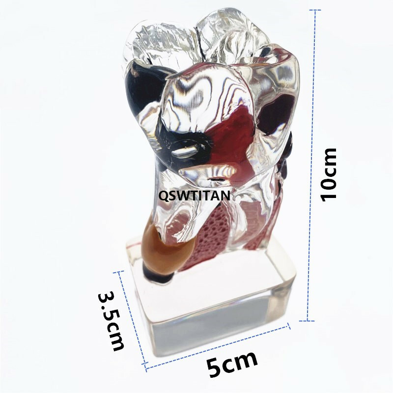 Teeth Model 4 times tooth pathology Comprehensive Periodontal teaching models