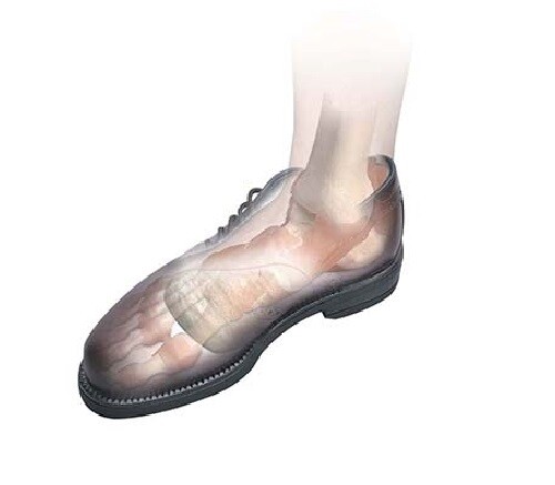Hapad Longitudinal-Metatarsal Arch Pads