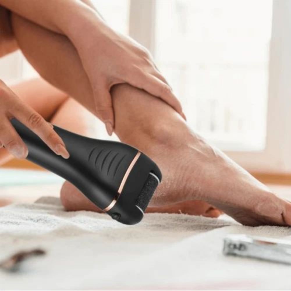 Electric callus remover test winner with3 replacement rollers to remove calluses