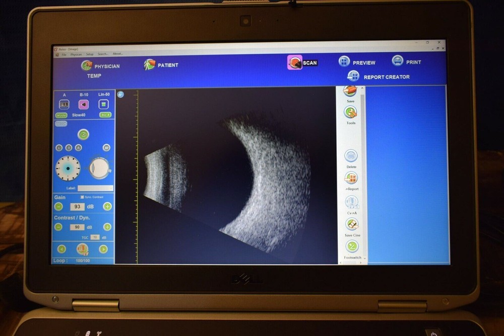 Quantel Aviso Bscan UBM ophthalmic ultrasound