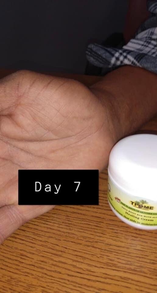TPOME, ALL NATURAL HEALING CREAM.