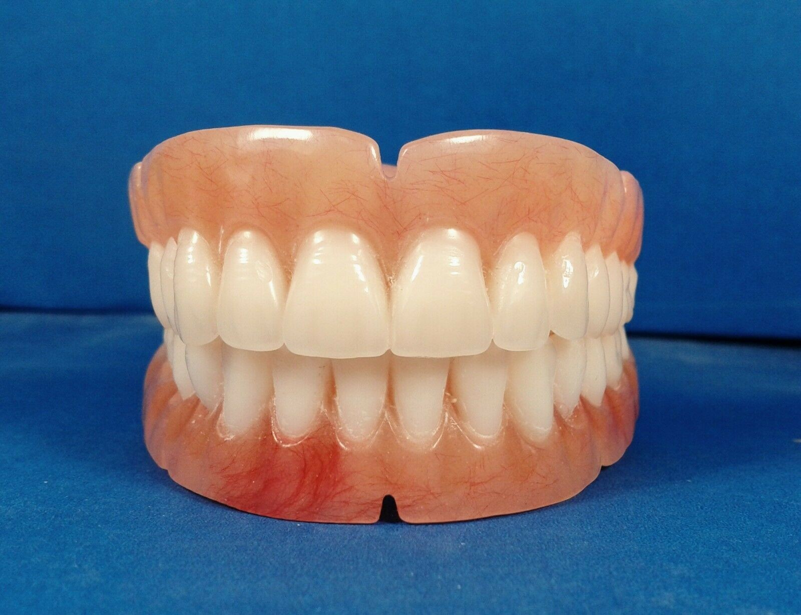 Dentures, set of false teeth with Hollywood bleach shade teeth