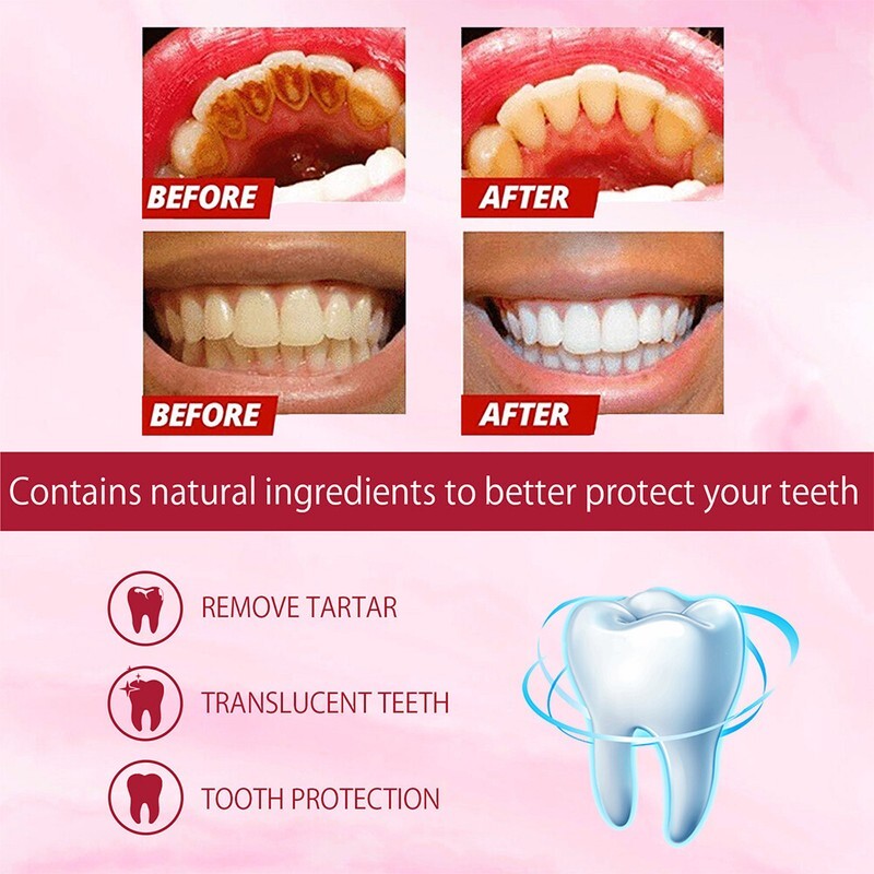 2PC Sp-6 Probiotics Whitening Toothpaste Brightening Breath Removing Toothpaste