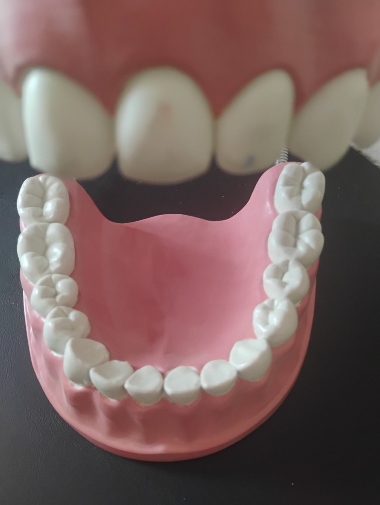 Large Anatomical Dental Model with Flexible Hinges for Educational Demonstration