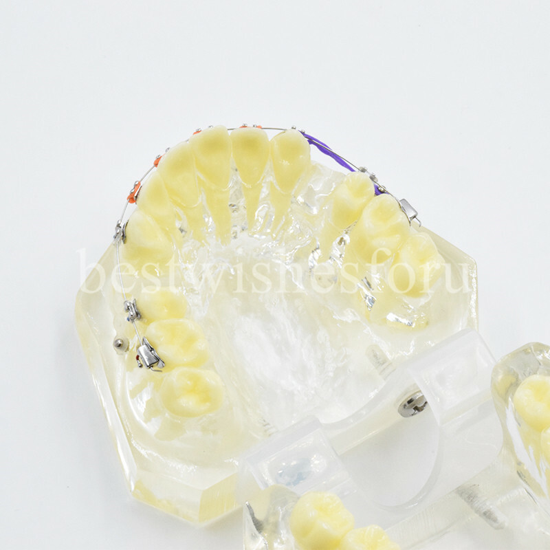 Dental Malocclusion Treatment Teeth Model Study Typodont Elastic chain 3005-2
