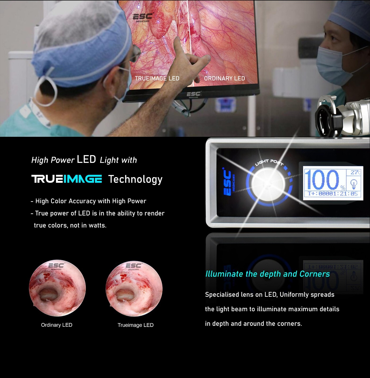Full HD Endoscopy Laparoscopic Camera with 120W Endoscope Cold LED Light Source