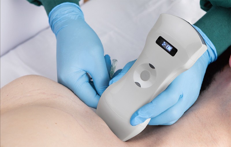 192 Elements convex/linear/phased array 3 in 1 Doppler Ultrasound Scanner