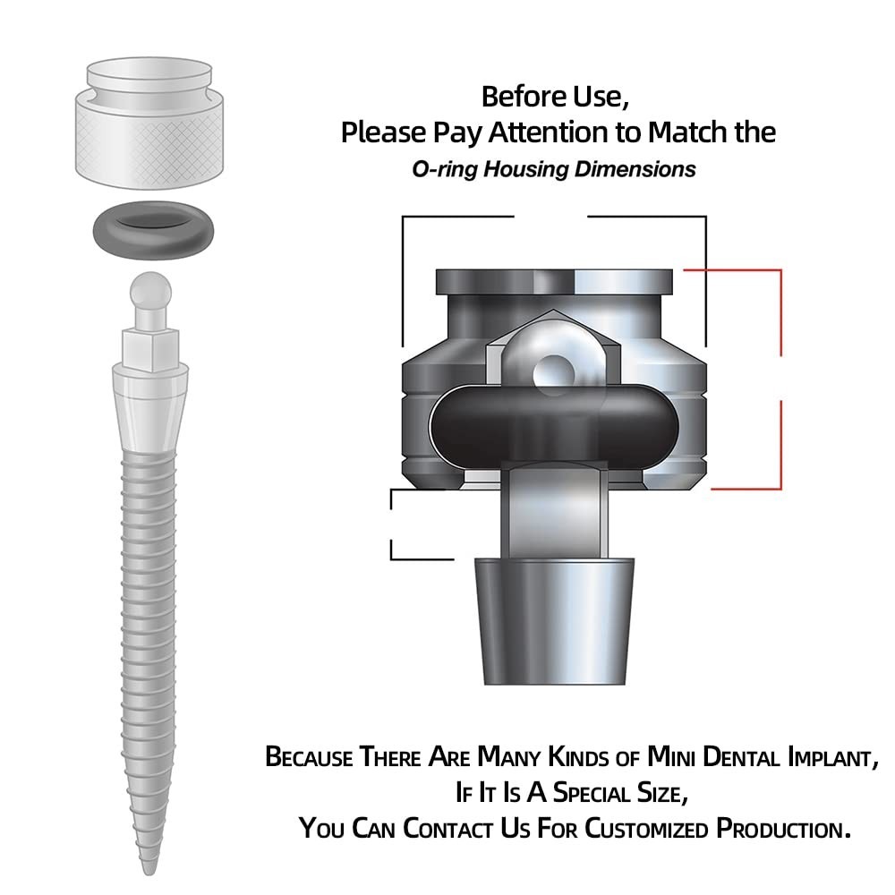 O-Ring, Buna-n, Tool Kit with 3 Convenient Sizes, Replacement for Mini Dental...