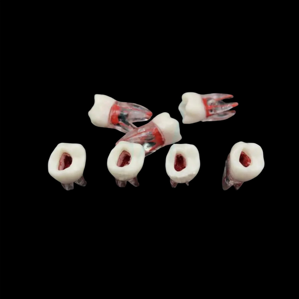 Dental Tooth Endo Root Canal Study Model For RCT Practice Blocks Pulp Cavity