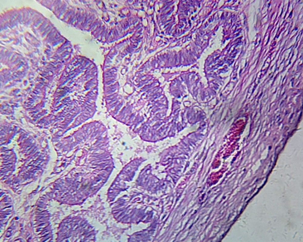 Fallopian Tube, Human; Showing General Oviduct Structure; Cross Section