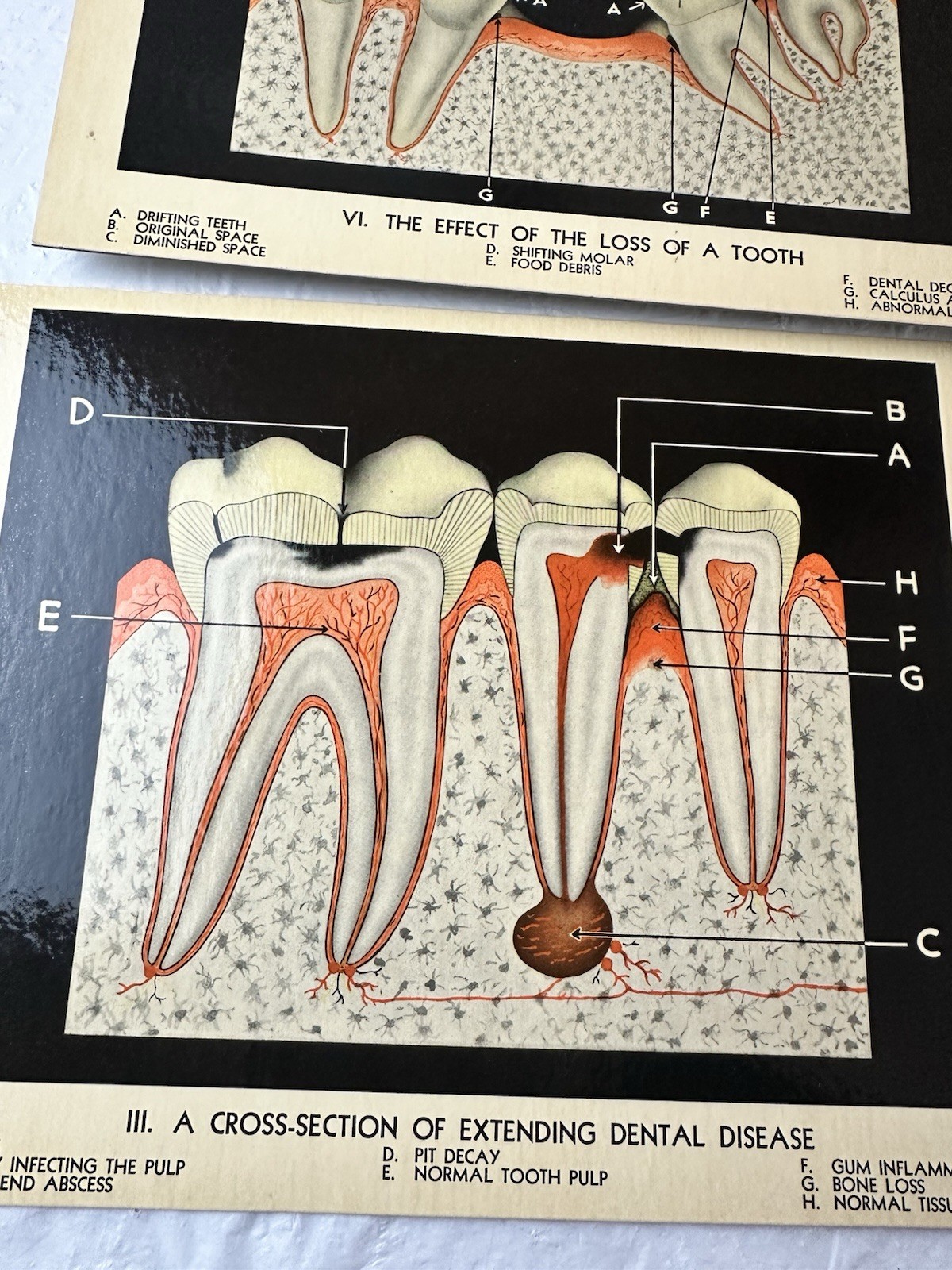 Vintage Lactona Inc Dental Anatomy Diagram Prints 11X8.5 Inches Dentistry