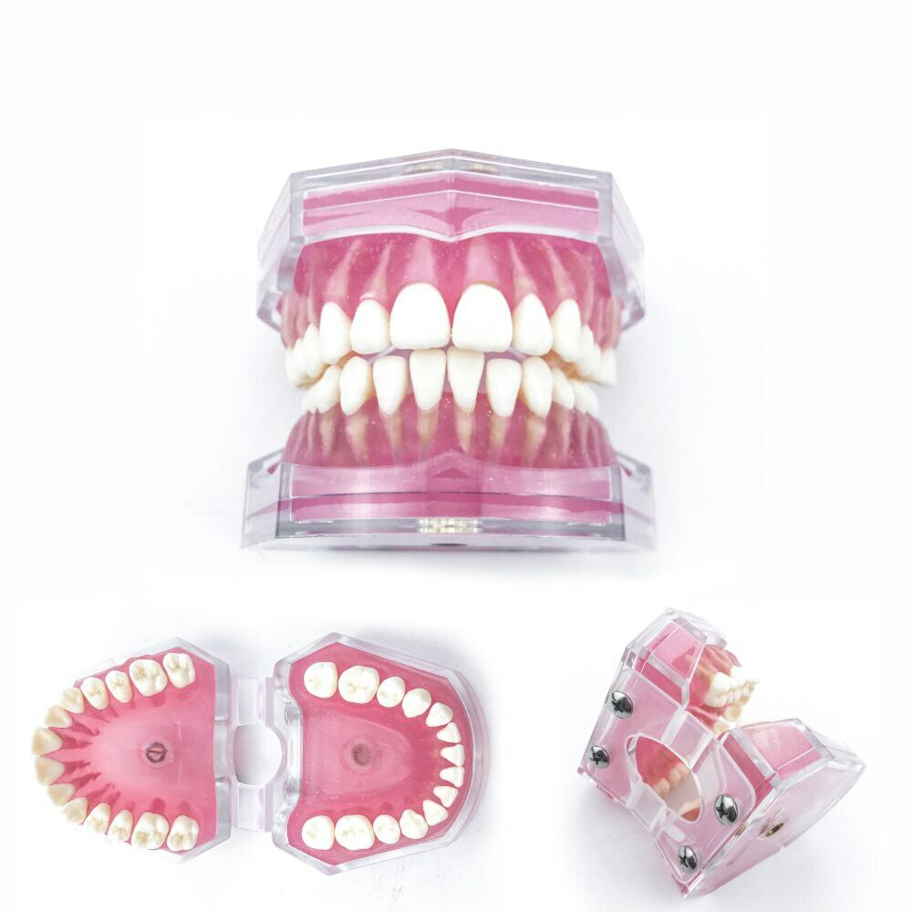 Teeth Model Dental Standard Model with Removable Teeth Dental Study Model