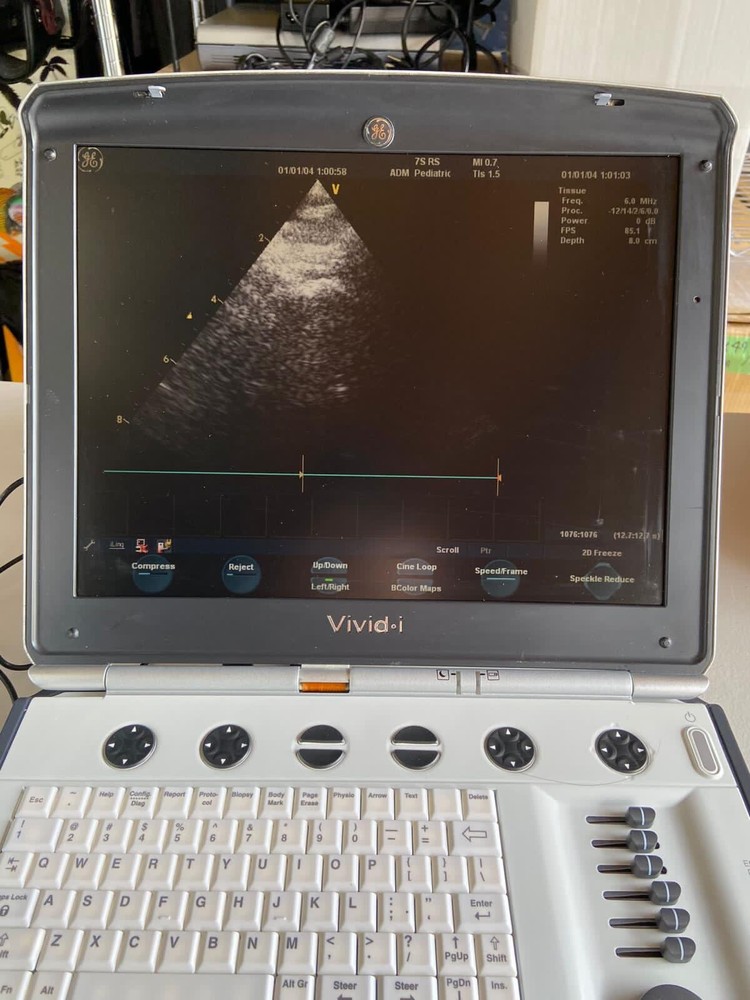 Ge ultrasound probe 7srs