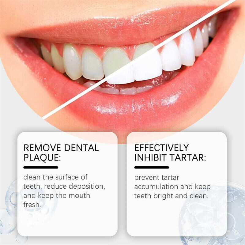 7.5% Hydroxyapatite Toothpaste Remove Yellow Tooth Stains For Sensitive Teeth~