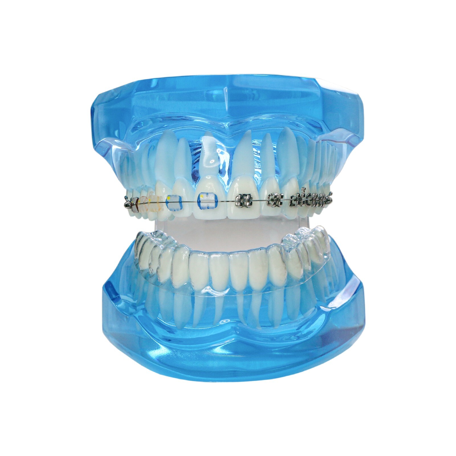 Dental Ortho Teeth Model With Metal Ceramic Brackets Lingual Braces Tube Teach