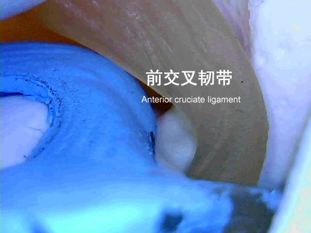 Knee Joint Model Arthroscopy Simulation Trainer Perfect for Medical Simulation