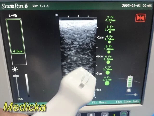 Chison Tech L-VA Linear Array Probe – Vascular Imaging for SR-6 (Tested) ~ 36100