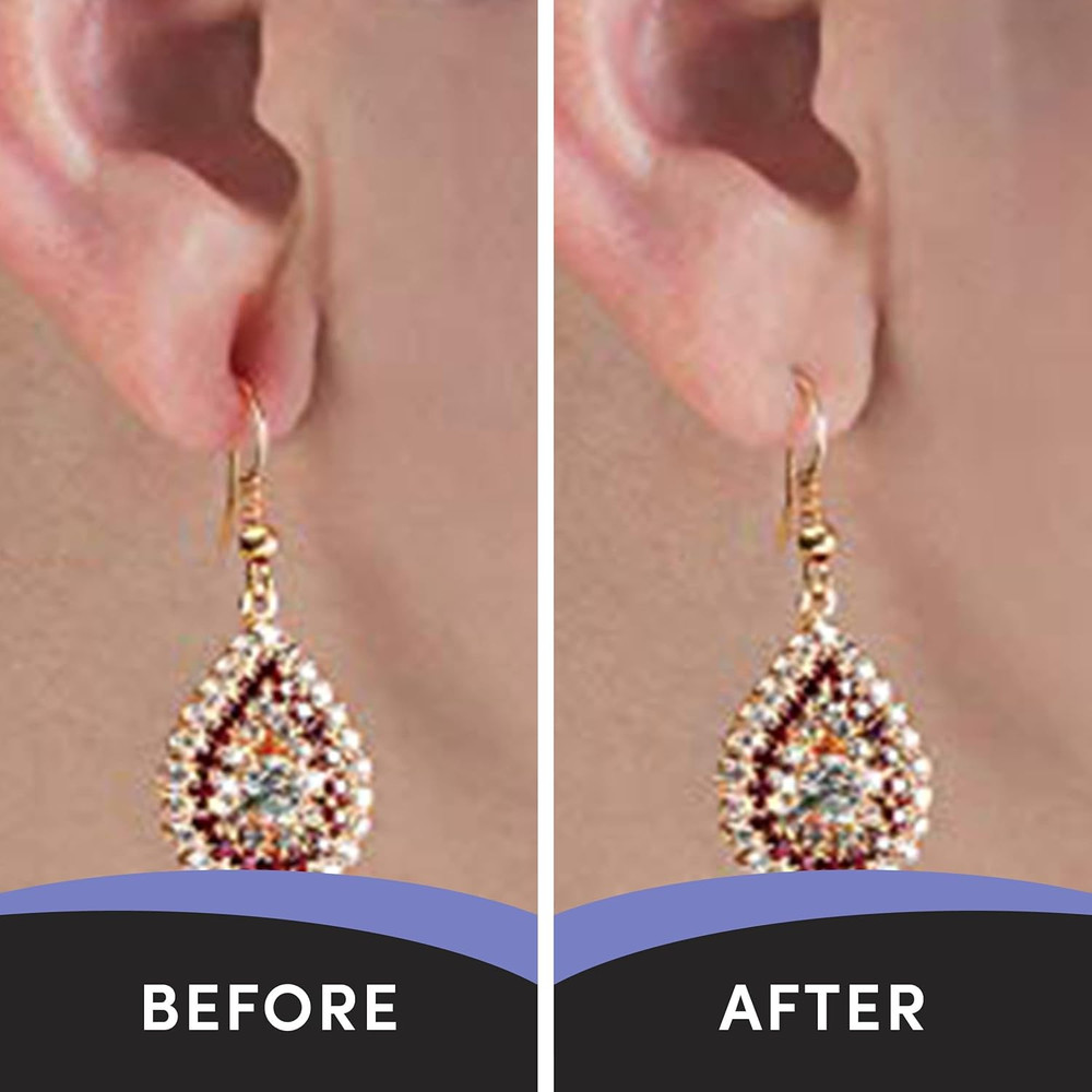 Lobe Miracle- Clear Earring Support Patches - Earring Backs for Droopy Ears - Ea
