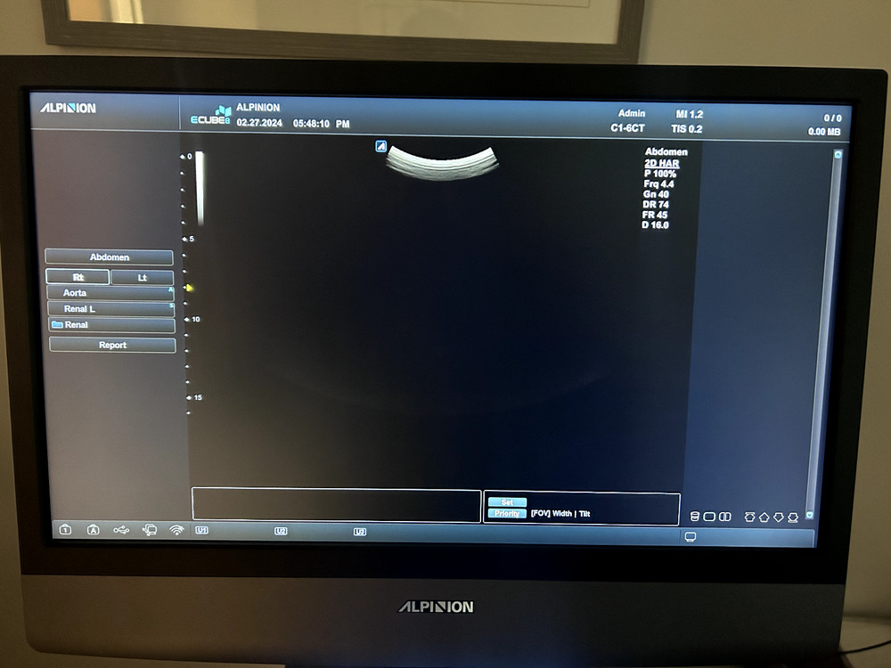Alpinion ECUBE 8 - Used