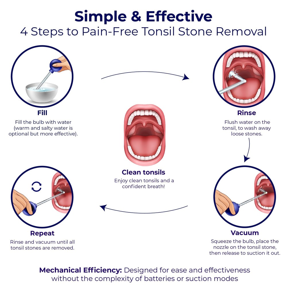 Tonsil Stone Remover Vacuum - Easy Suction Tool for Tonsil Stone Extraction