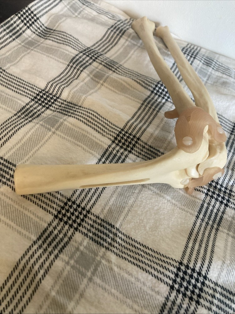 Somso Anatomical Elbow Joint Model. Read