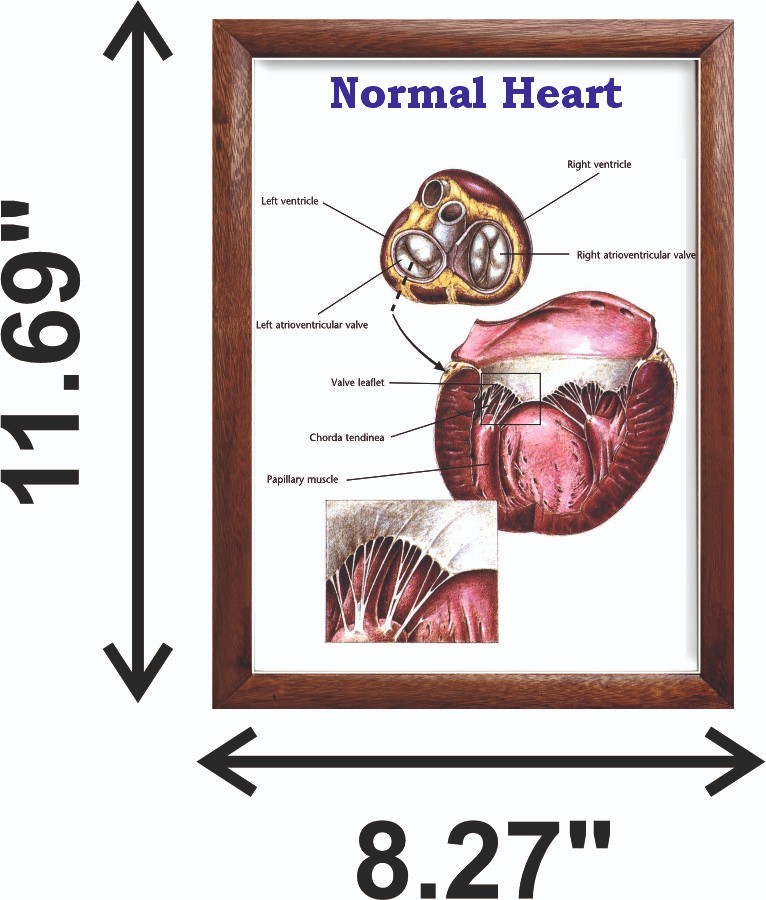 Normal Heart Chart 12x18 inches