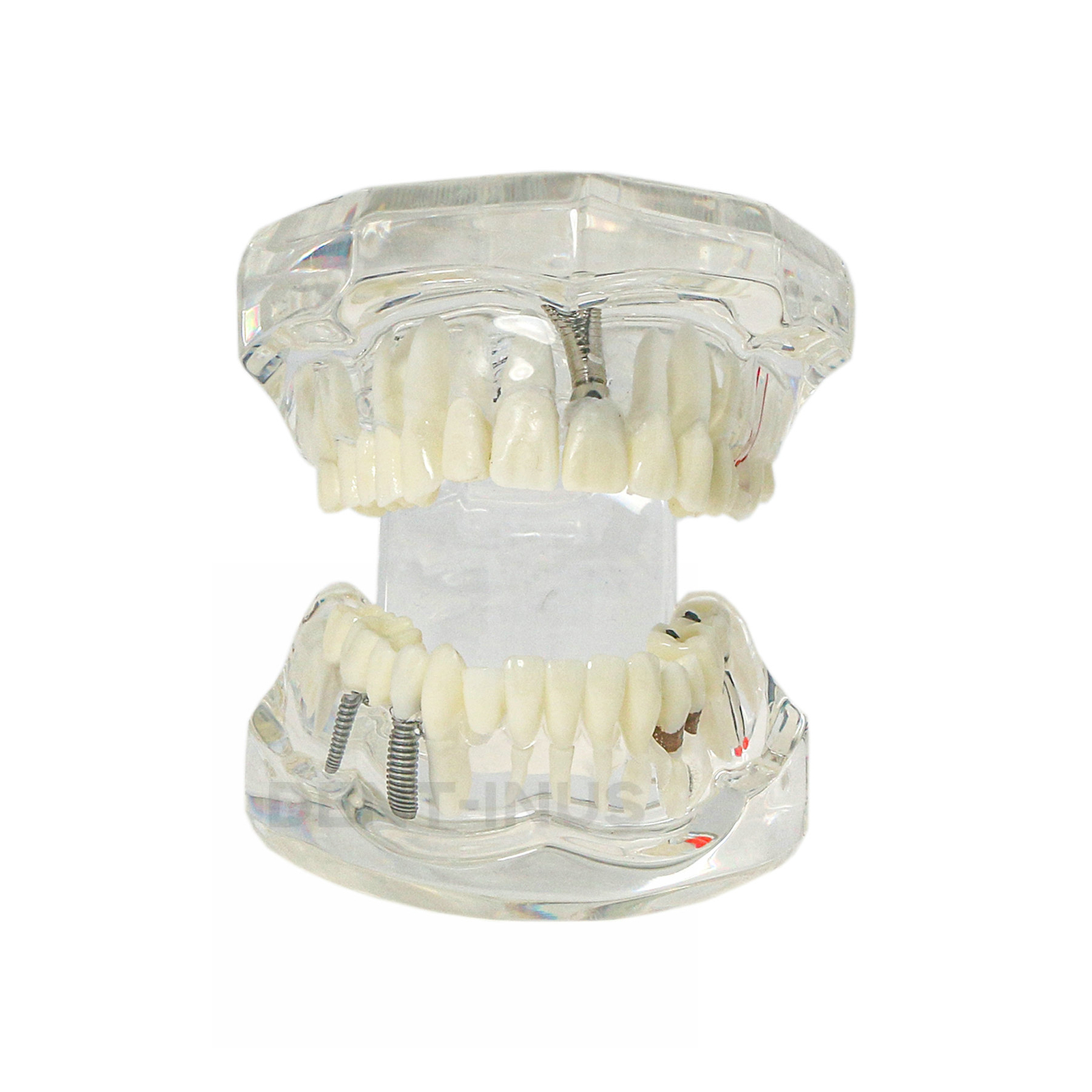 Dental Oral Typodont Model Implant Pathological Teaching Standard Size (Clear)
