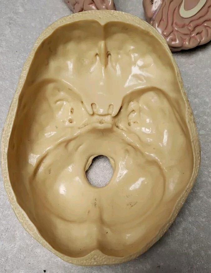 GPI Brain/ Partial Skull Model