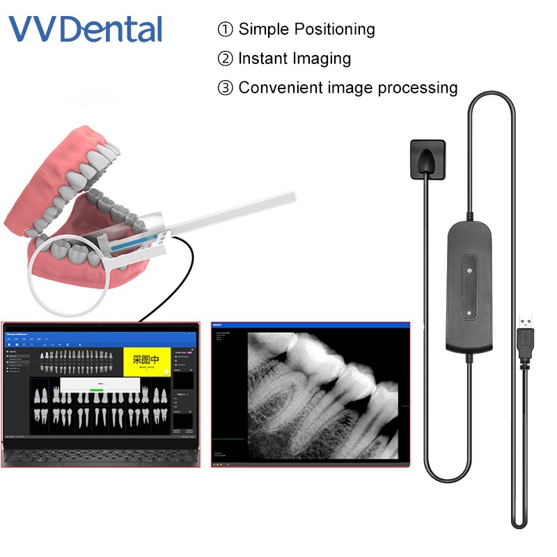 1 Year Warranty Dental RVG Sensor High-Frequency Digital Sensor Dentist HD Image