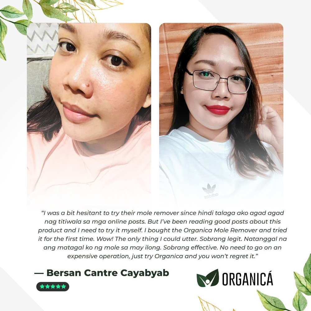 Multi-Awarded Mole and Warts Remover Set