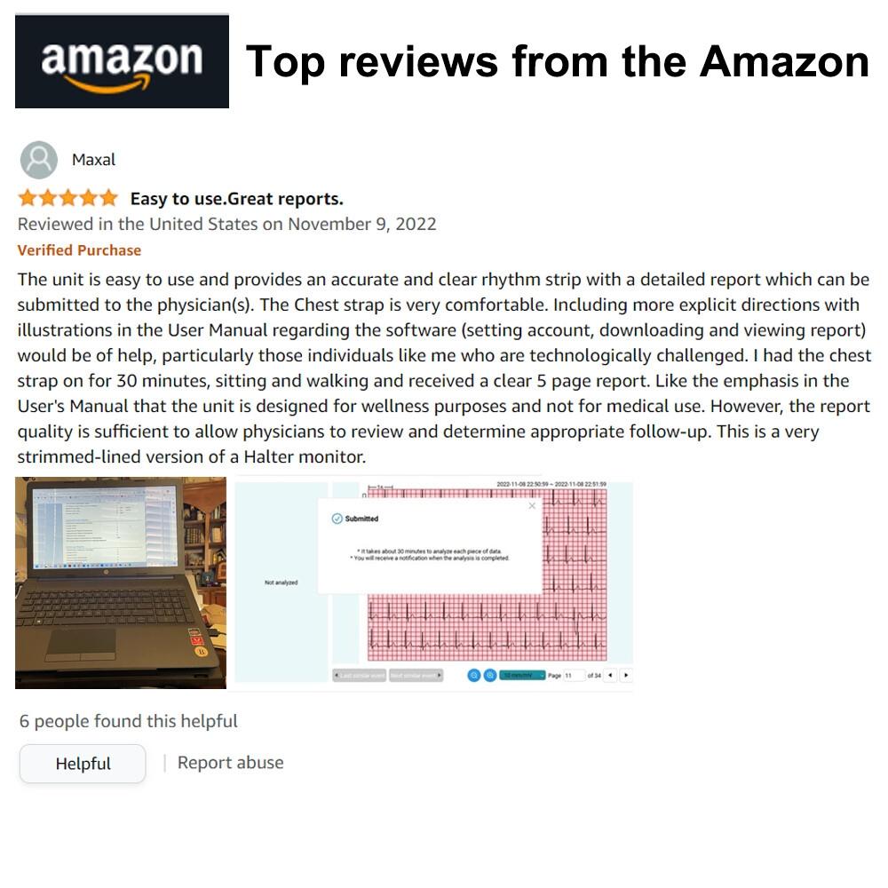 24 hours ECG/EKG Holter Monitor System with AI analysis Detects Afib PC Software