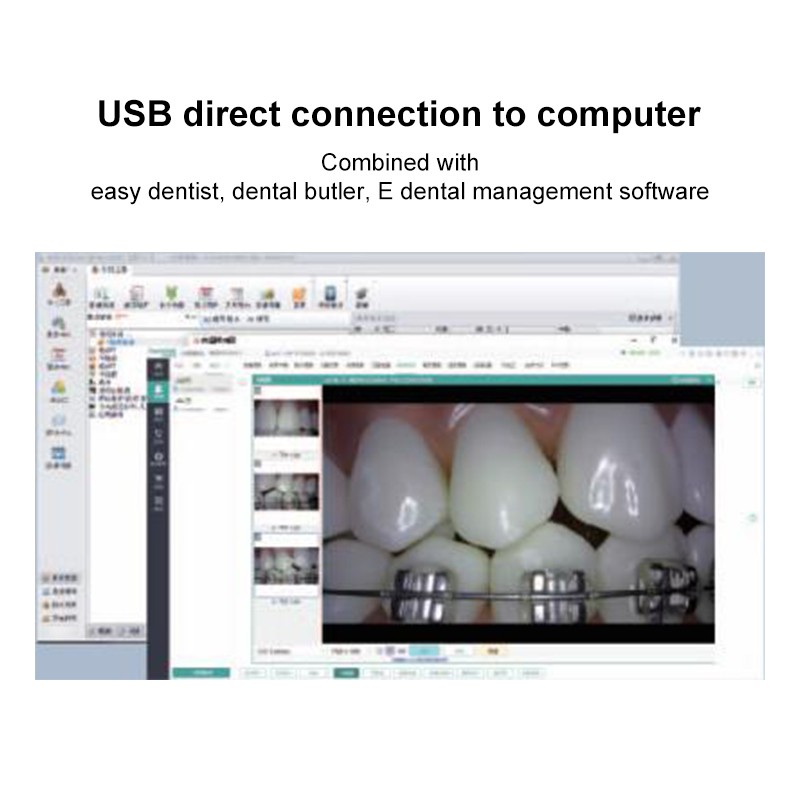 Dental Intraoral Camera USB Digital lmaging Intra Oral HD Camera 4K Mega Pixel