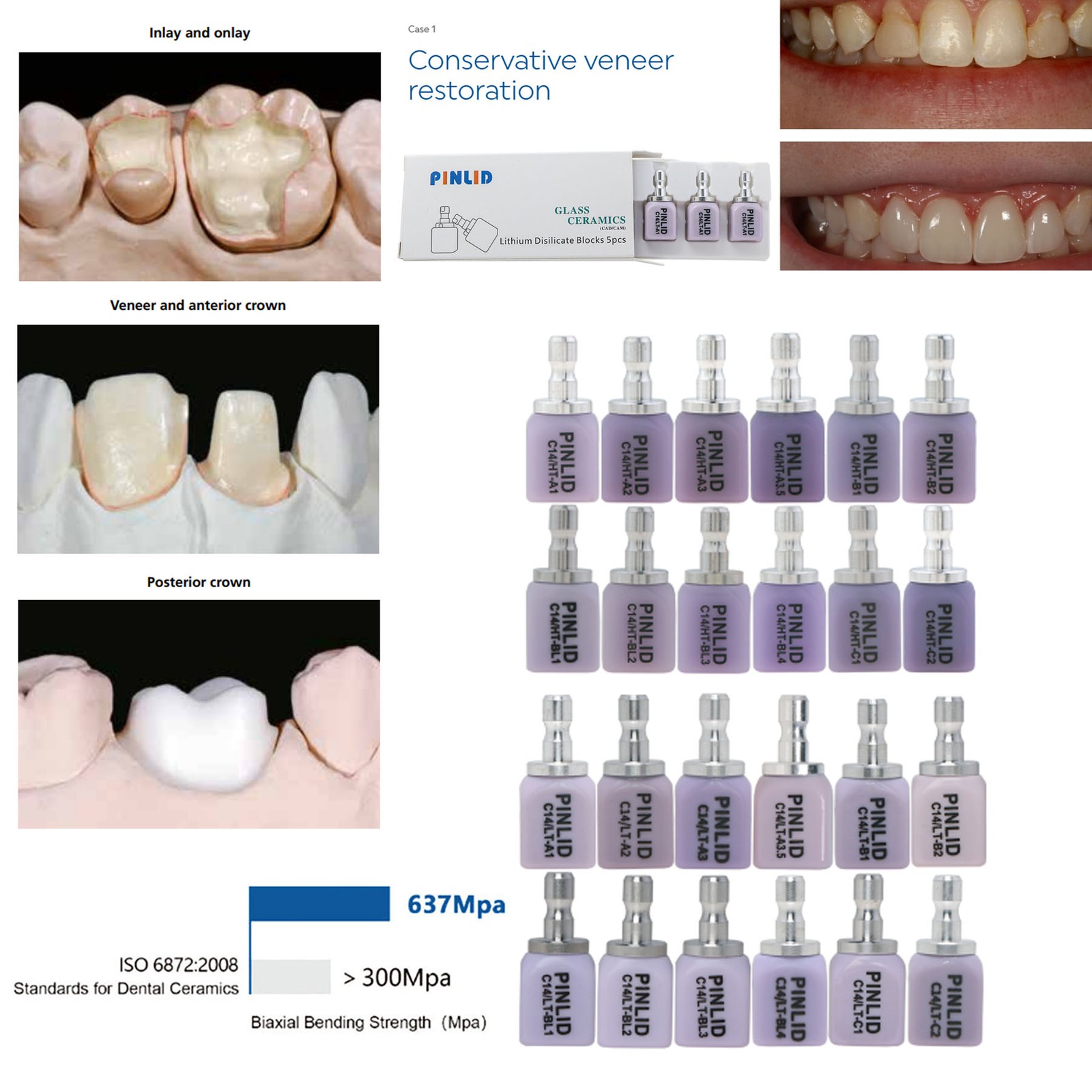 Lithium Disilicate Glass Ceramic IPS e.max CAD HT/LT Blocks For inLab C14/5pcs