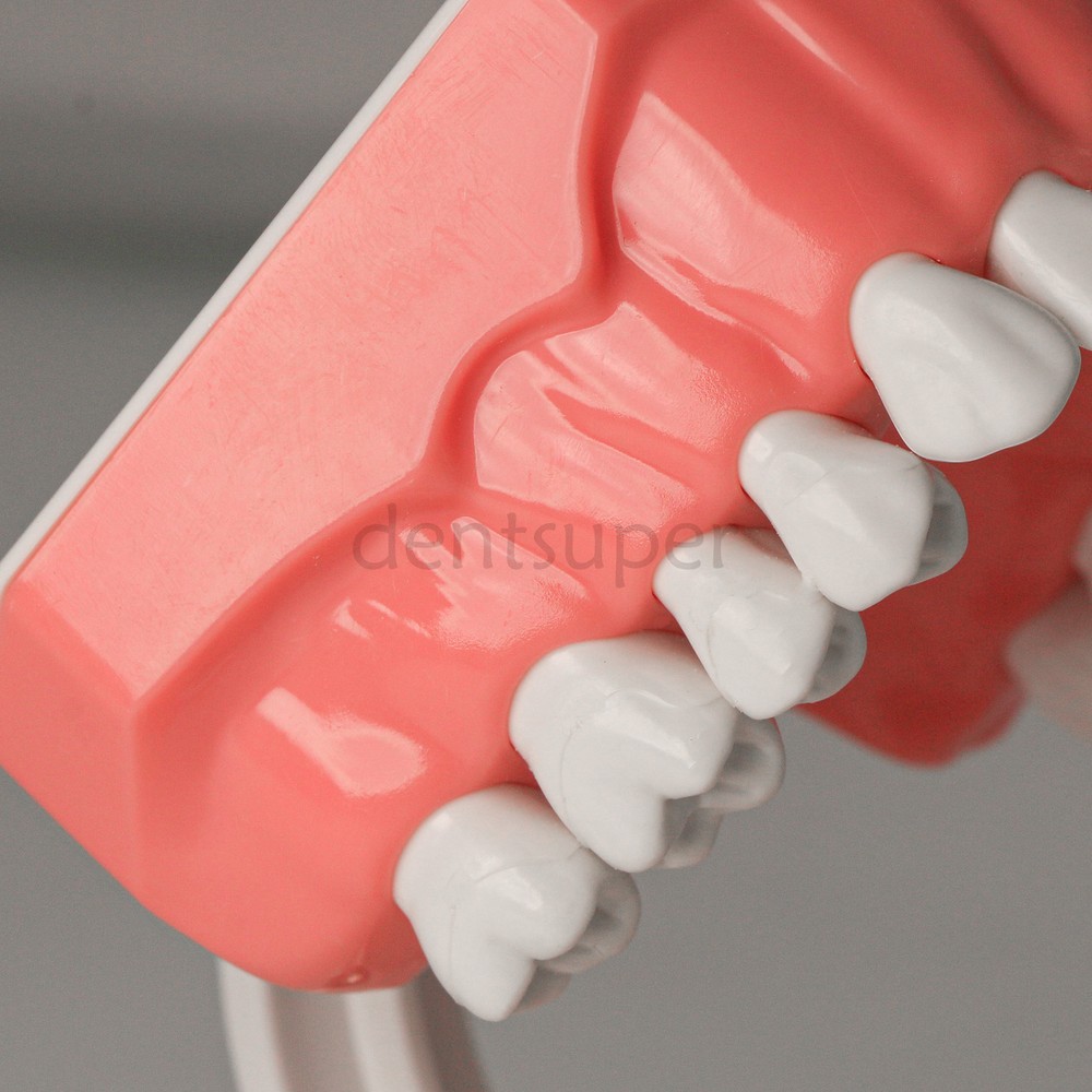Dental Teach Study Typodont Teeth 1:1 Model With Metal Ceramic Brackets Tubes