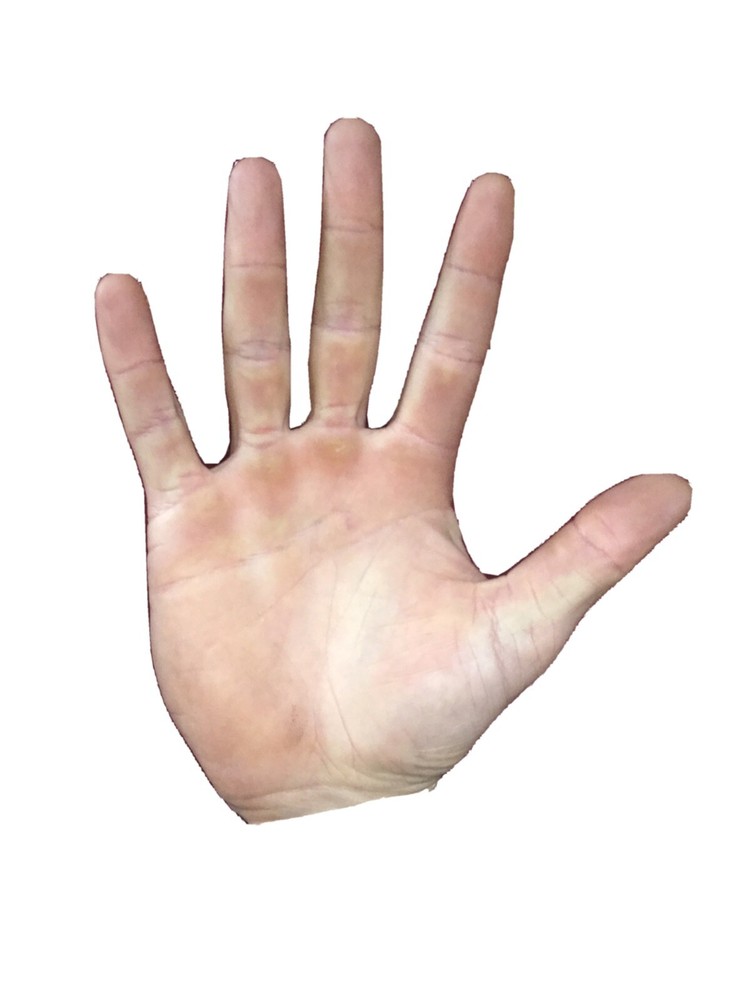 A High Five