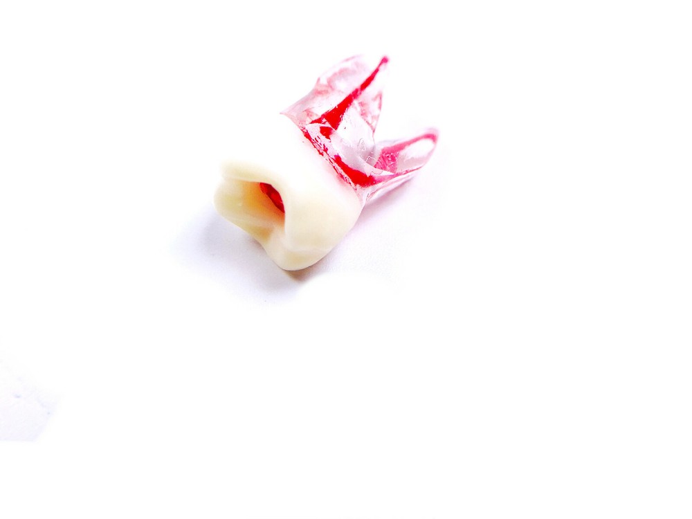 Dental Endo Root Canal File Training Study Model Student Practice Block Red Pulp