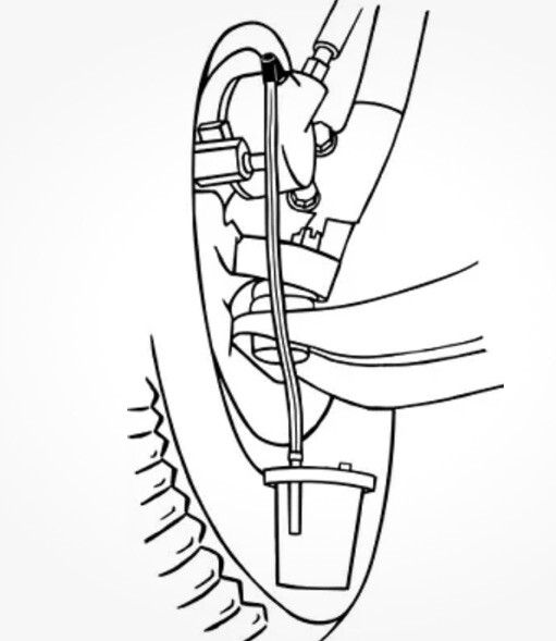 Lisle 19200 Brake Bleeding Kit
