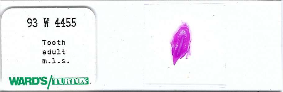 Adult Tooth Microscope Slide