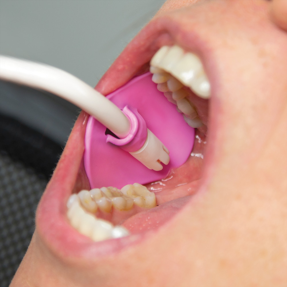 Zirc Pink Petal (Pkg. 100)