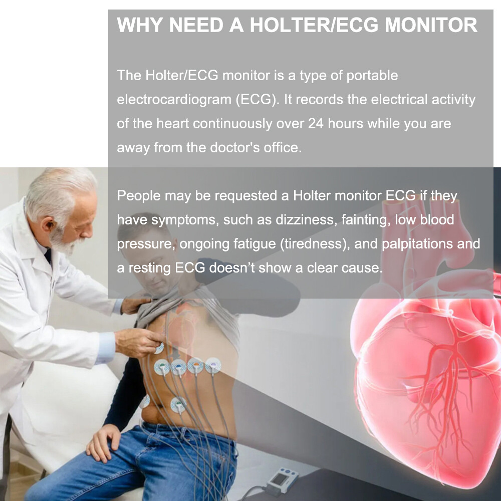 12 Lead Holter Monitor Recording 24h ECG and Heart Rate AI Analysis Abnormal ECG