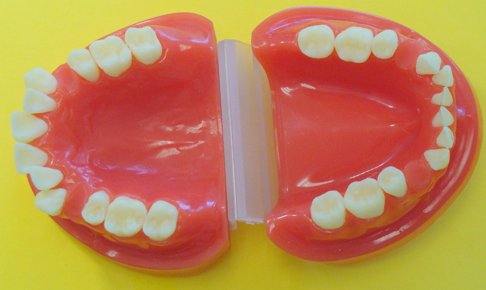 Orthodontic Typodont  Teeth Anormal TYP-2 ARTMED